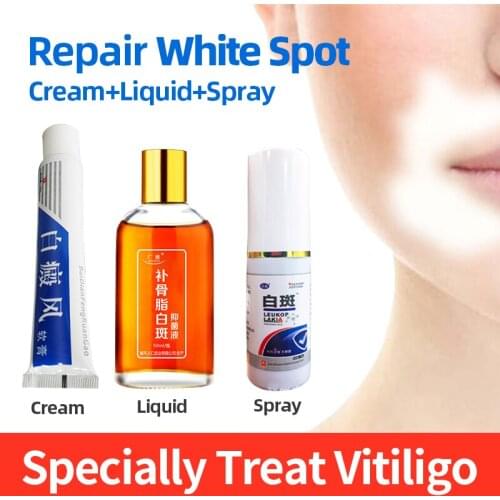 Chinese Medical White Spot Repair Ointment Pigment Melanin Promoting Liniment Skin Vitiligo Leukoplakia Disease Treatment