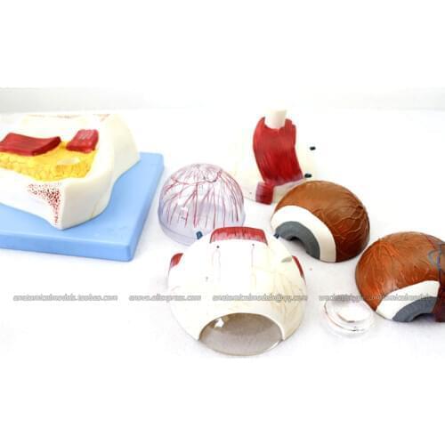 CMAM/12529 Eye- Eyeball, 5X life size, 7parts, Human E.N.T. Medical Teaching Anatomical Model