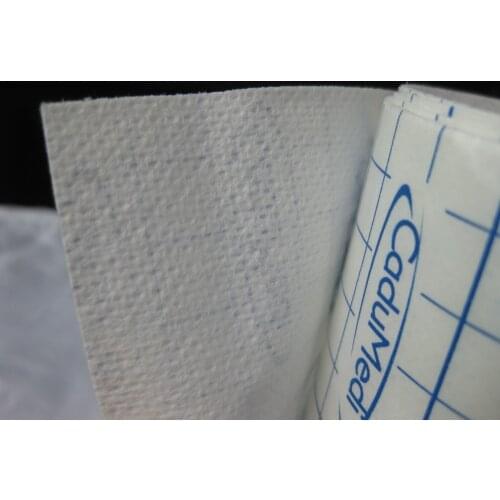 2rolls 15cm*10m non-woven adhesive tape fabric tape medical Nonwoven wound dressing no residue fabrics dressing