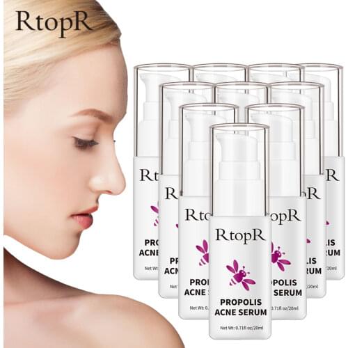 10 pcsPropolis Repair Acne Serum Skin Brightening Cream Acne Scar Cleansing Serum Shrinkage Elimination Acne Treatment Skin Care
