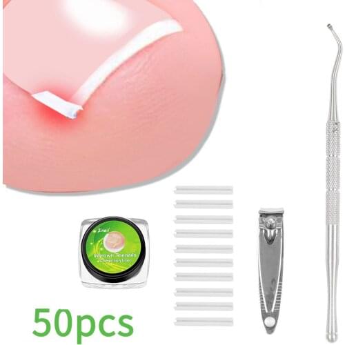 5pcs/box Ingrown Toenail Corrector Ingrown Toe Nail Treatments Elastic Patch Sticker Toenail Straightening Pedicure Tools