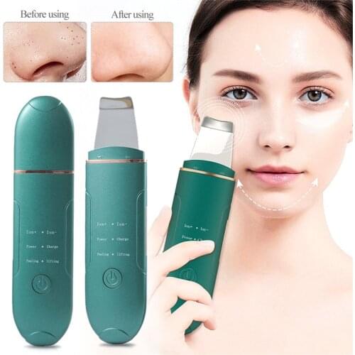 USB Recharge Skin Scrubber Vibration Face Spatula Blackhead Remover Facial Scrubber Shovel Clean Cavitation Peeling