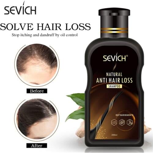 Sevich 200ml Anti Hair Loss Shampoo Ginger Hair Growth Shampoo for Hair Professional Shampoo Bar Hair Loss Treatment Hair Care