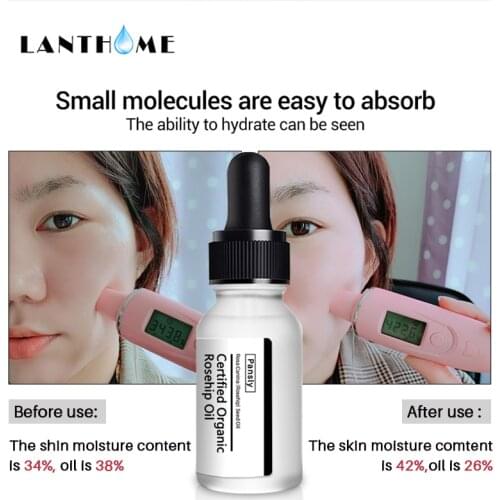 10ml Original Pure Rosehip Essential Oil Anti-Aging Spots Stretch Marks Remover Relieve Stress Organic Skin Care Ageing skin