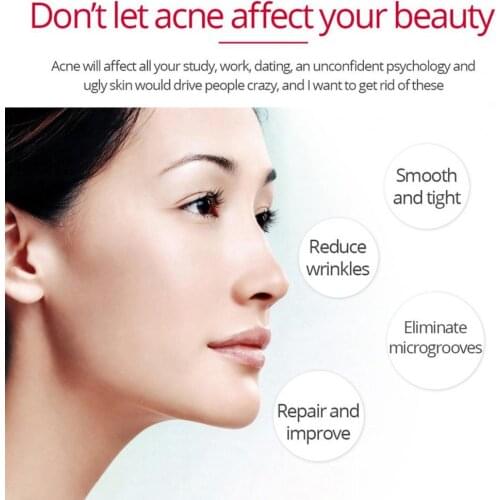 80% Hot Sale 30g Peptide Face Cream Face Lifting Wrinkles Removing Natural Extract Collagen Pure Face Whitening Anti Aging Cream