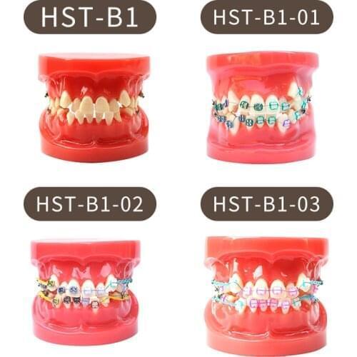 Ortho metal and ceramic tooth model Various Dental Teeth Models Are Used For Teaching And Hospital Dentist Material