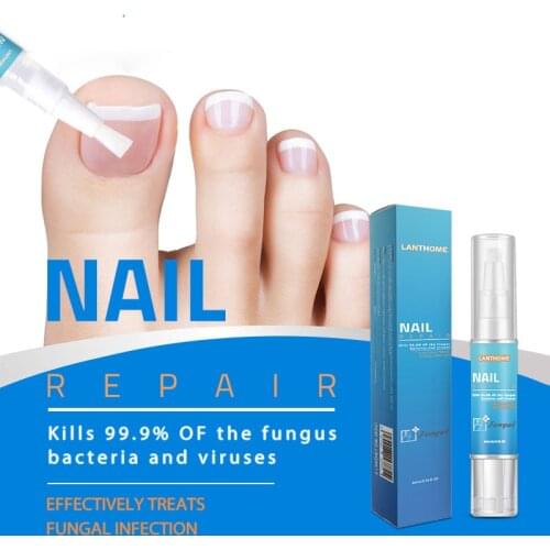 Nail Treatment Pen Onychomycosis Paronychia Anti Fungal Nail Infection Chinese Herbal Toe Fungus Care Repair Serum