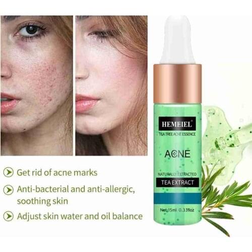 Tea Tree Acne Essence Can Effectively Reduce Acne Spots Skin Care Shrink Pores Repair Whitening And Moisturizing Essence