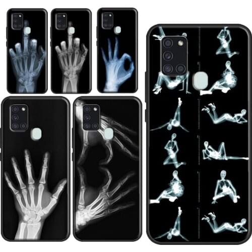 X-ray Hand Bones Case For Samsung Galaxy A21S A20e M21 M31 A11 A01 A51 A71 A50 A70 A30S A31 A10 A40 A7 2018