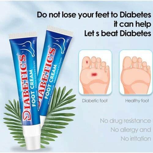 Diabetic Cream For Foot Care Herbal Ointment Relieve Toe Fungus Anti Fungal Infection Eczema Urticaria Beriberi Foot Care 20g