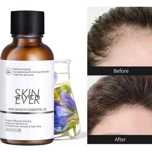 SKIN EVER Hair Growth Oils Hair Smoothing Nourishing Hair Care Hair Loss Dry Damaged Treatment Serum for Home