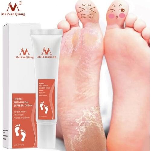 MeiYanQiong Herbal Anti Fungal Relieve Beriberi Foot Cream Skin Care Toe Treatment Anti Fungal Infection Foot Repair New Product