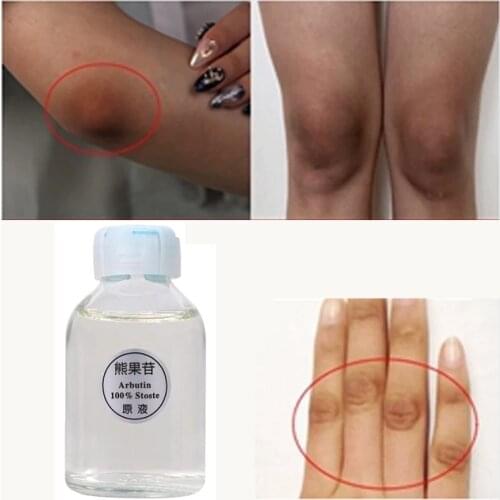 Cosmetics Skin care Essence Whitening Lightening Brightening Face Serum Kojic Acid Serum Bleaching Cream face care Makeup