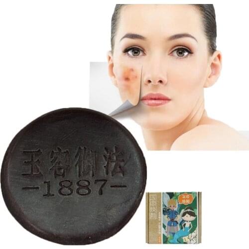 Acne Soap Handmake Removal Pimple Pores Treatment Whitening Moisturizing Cleaner Face Care For Wash Basis