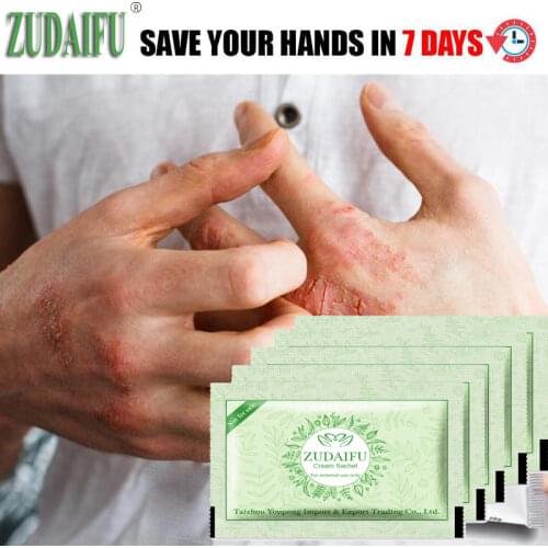14PCS/Lot zudaifu Small package sample installation Body Psoriasis Cream Dermatitis and Eczema Pruritus Psoriasis Ointment