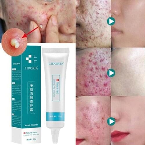 Антиперспиранты BellyLady China At AliExpress