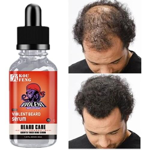 Effective Hair Growth Serum Fast Regrowth Thick for Hair Prevent Hair Loss Damaged Hair Repair Natural Hair Care Products 30ML