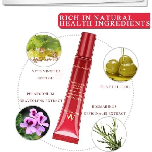 Acne Scar Stretch Mark Repair Cream Treatment Blackhead Whitening Cream Skin Repair Face Cream Quickly restore skin