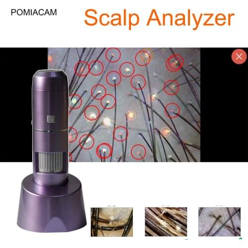 AI 1200P Wireless WiFi Hair Follicle Scalp Tester Connection Mobile Phone Tablet Hair Digital Skin Analyzer