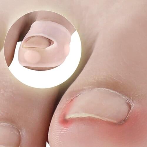 1Pair Silicone Ingrown Toenail Correction Tool Invisible Toe Nail Treatment