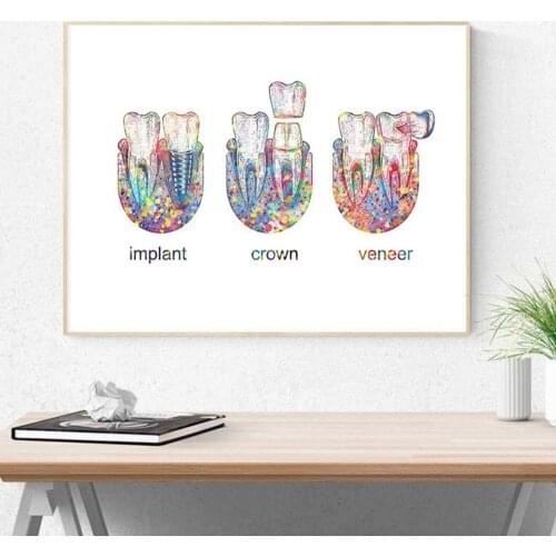 Tooth Implant Art Dental Crown Print Dentist Gift Tooth Anatomy Medical Wall Art Canvas Painting Picture Dental Clinic Decor
