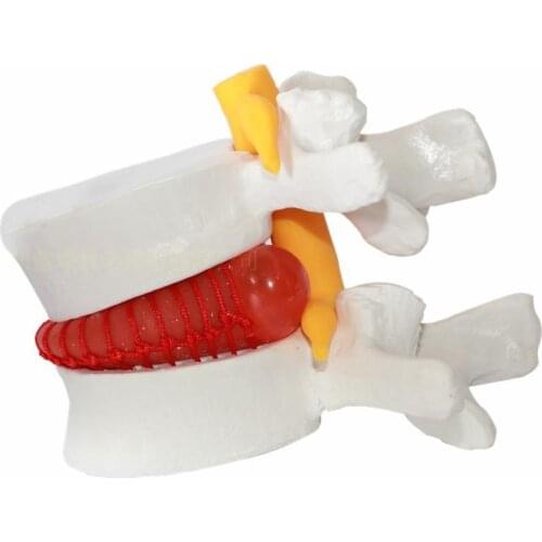 Human anatomy skeleton Spine Lumbar Disc Herniation Teaching Model brain skull traumatic pistol school supplies medical instrume