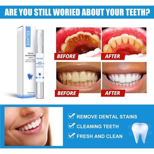 Teeth Whitening Pen Bleaching Cleaning Serum Remove Plaque Stains Dental Professional Kit Oral Hygiene Teeth White Gel Pen Tools