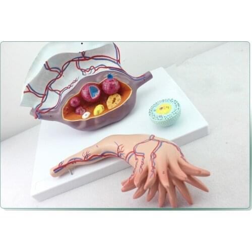 Free Shipping& Human Ovarian Structure, Ovarian Enlargement, Plan Parenthood Demonstration Model for Medical and Beauty Parlor