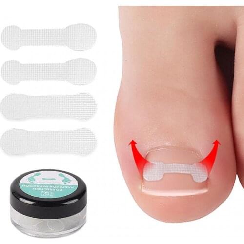 Nail Ingrown Corrector Nail Patch Correction Stickers Patch Corrector Nail Treatments Toenail Straightening Correctors Foot Care