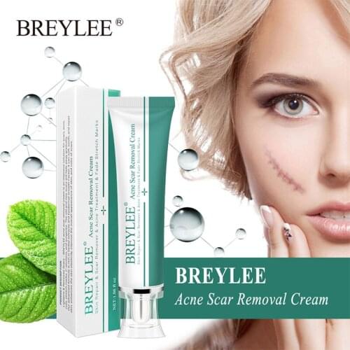 BREYLEE Acne Scar Removal Cream Skin Repair Fade Pimples Scar Stretch Marks Acne Treatment Whitening Moisturizing Face Gel Care