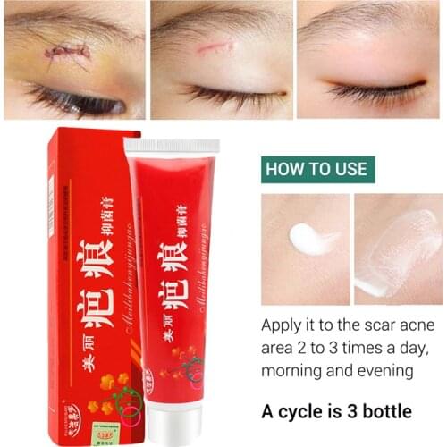 60G Acne Scar Removal Cream Pimples Stretch Marks Face Gel Remove Acne Smoothing Whitening Moisturizing Body Skin Care