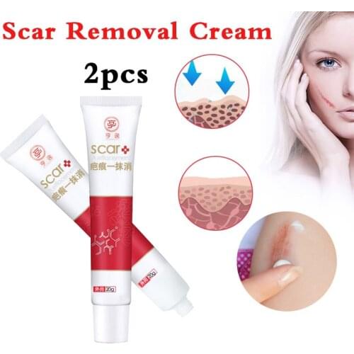 1/2pcs Scar Removal Ointment Scar Recovery Cream Facial Repair Scar Mark Treatment Burn Ointment 20g Natural Herbal Cream