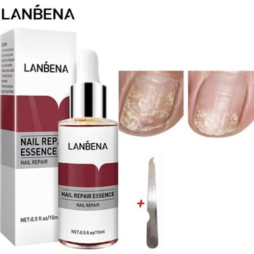 Nail Repair Essence Anti Infection Removal Gel Paronychia Onychomycosis Brighten Cuticle Treatment Hand Foot Nai Care