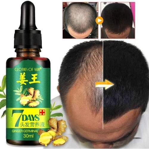 1PC Fertilizer For Hair Growth Serum Essence For Men And Women Fluid Hair Growth Essence Healthy Hair Loss Treatment 30ml