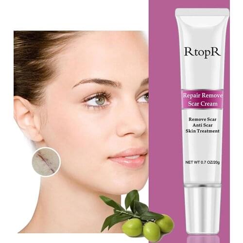 Acne Scar Remover Cream Skin Stretch Marks Repair Face Cream Acne Spots Acne Treatment Blackhead Whitening Skin Care Cream 20g