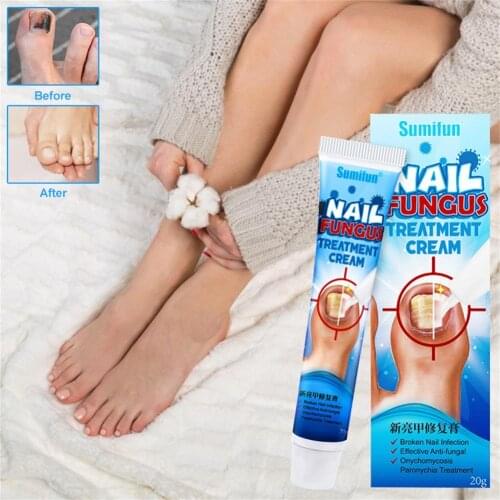 20g Nail Repair Cream Bright Nails Gray Nail Treatment Cream Anti Fungal Nail Infection For Paronychia Toe Nail Fungus Health Ca