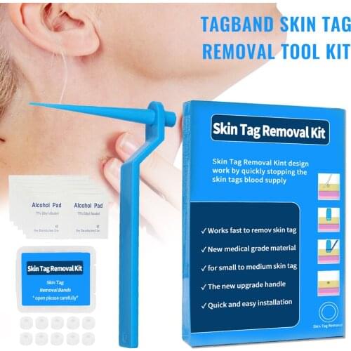 1set Skin Tag Kill Skin Mole Wart Remover Micro Skin Tag Removal Kit with Cleansing Swabs Adult Mole Wart Face Care