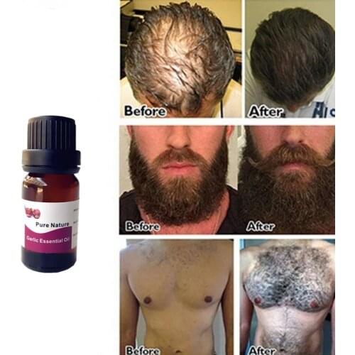 New Garlic Growth Essential oil beards hair Thicker Essence Mustache Thick sideburn Treatment Sunburst alopecia Serum Products