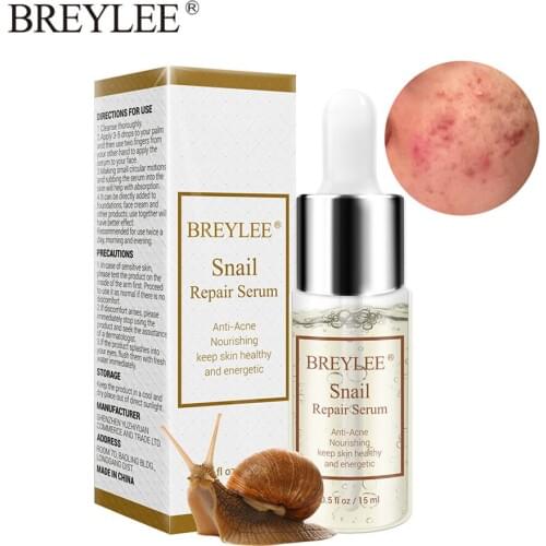 BREYLEE Snail Repairing Serum Anti-Acne Rejuvenation Essence Scars Acne Treatment Liquid Face Skin Care Nourishing Moisturizing