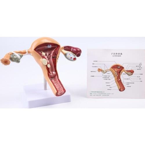Female reproductive uterus model diseased uterus model teaching aid gynecological anatomy ovary teaching model