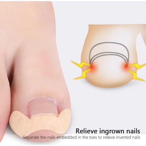 5pcs Pedicure Ingrown Nail Tool Toenail Sticker for Nails Corrector Paronychia Treatment Fixer Recover Bunion Pedicura Feet Care