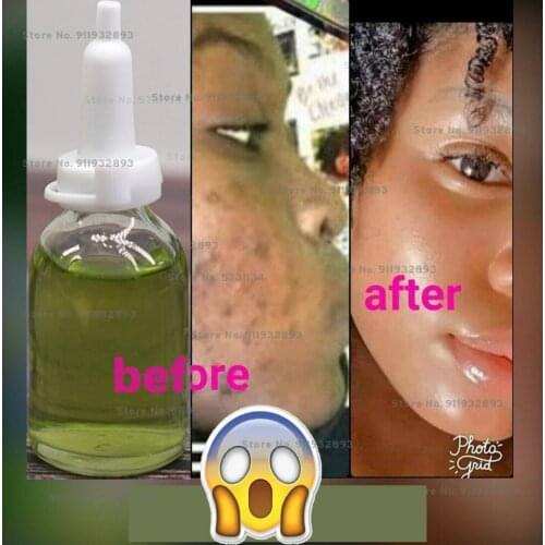 BRADYEXPRESS Moisturizing Face Serums