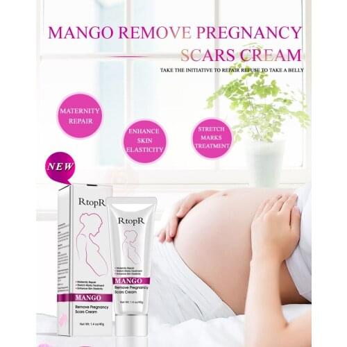 Mango Improves Body Reduces Wrinkles Remove Skin Scars Treatments Pregnant Women Skin Chest Buttock Cream Increases Elasticity