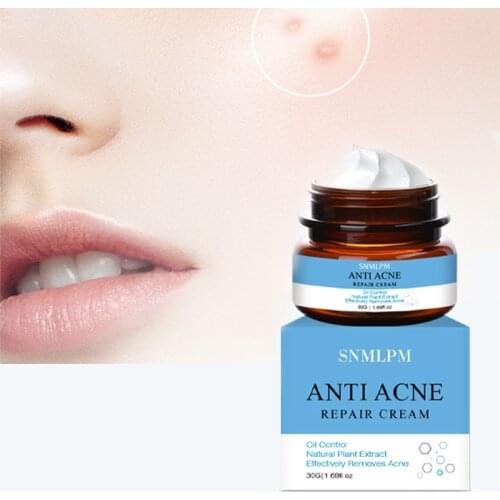 Beauty skin acne cream acne scars cream repair fade marks 30g anti-acne cream acne scar removal cream skin care products