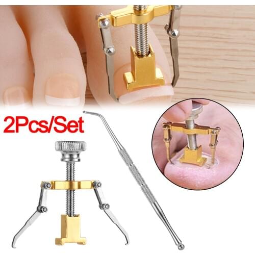 Ingrown toenails correction pedicure foot toe nail care tools file Elastic Patch Straightening Clip Brace corrector Wire Fixer