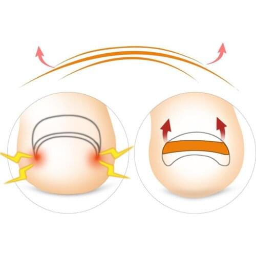 Ingrown Toenail Correction Sticker Set, Professional Clear Correction Patch to