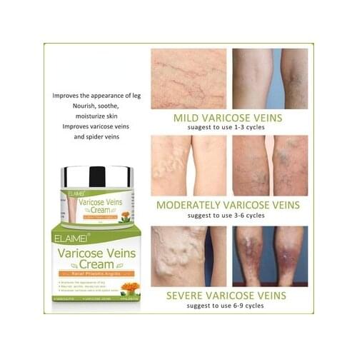 50g Intravenous Cream OintmentEarthworm Hamstring Bulge Relief Pain Red Blood Streak Repair Vein Cream