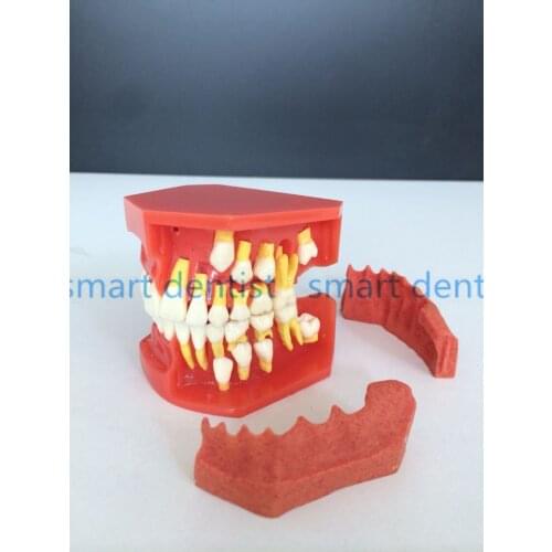 Good Quality 2017 New Arrival Dental Tooth Teeth Anatomical Anatomy Model Children Dental Model