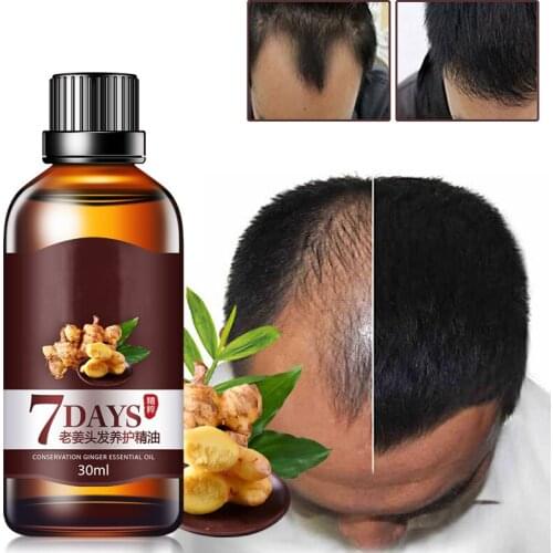 Repair Hair Loss Growth Serum Health Care Beauty Dense Nourishing Treatment Hair Loss Liquid 7 Days Fast Hair Growth Essence Oil