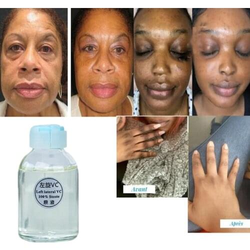 30ML Corrective Skin-lightening Moisturize Cream Face Serm For Hyperpigmentation for Face Hands Feet